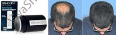 Nanogen Nanofibres + Locking Mist Plus Набор Камуфляж для волос для зоны поредения и облысения Нанофайберс (Нановолокна) + фиксирующий спрей