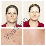 Skin Doctors Gamma Hydroxy™ Обновляющий крем для кожи лица против морщин и различных проявлений пигментации 50 мл