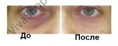 Skin Doctors Eyecircle Крем для эффективного устранения темных кругов под глазами 15 мл (срок 05.2015)