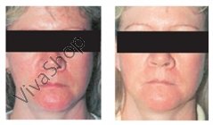 Skin Doctors Capillary Clear Многофункциональный крем для лица от поврежденных капилляров 50 мл